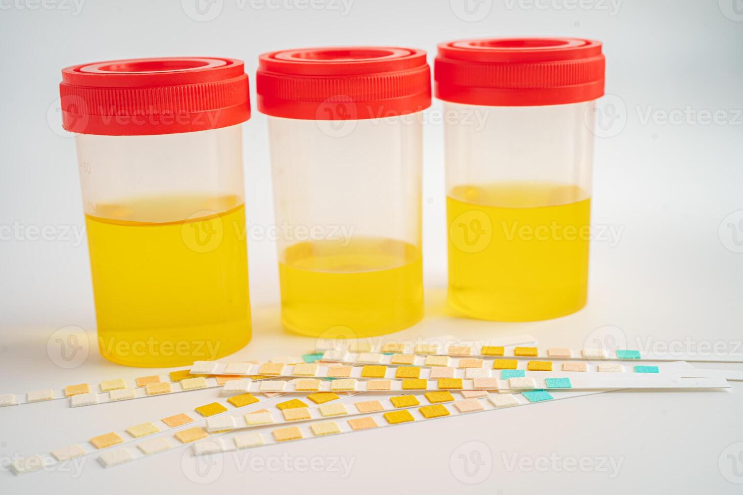 Urinalysis, urine cup with reagent strip pH paper test and comparison chart in laboratory. photo