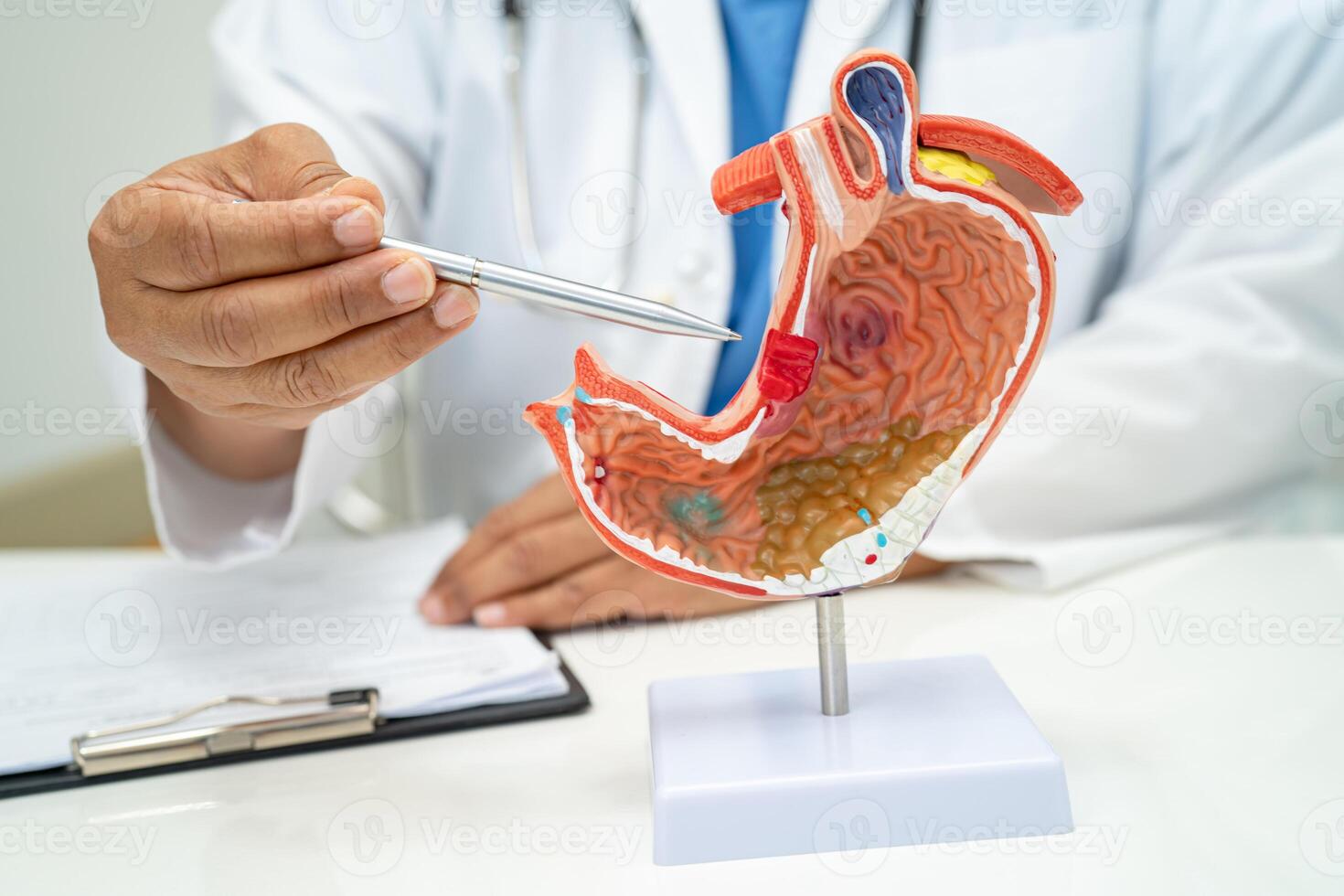 Stomach disease, doctor with anatomy model for study diagnosis and treatment in hospital. photo