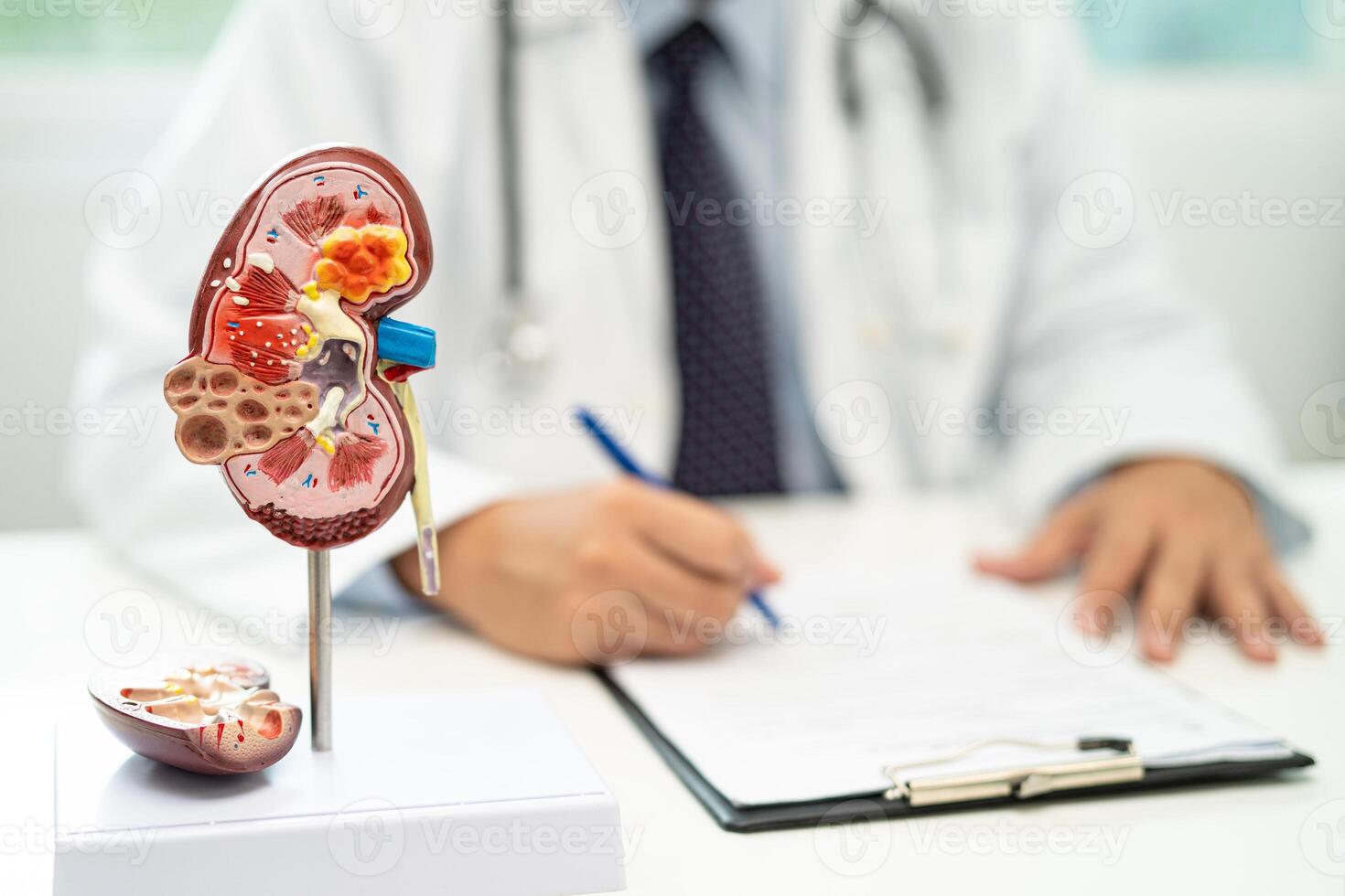 Kidney disease, Chronic kidney disease ckd, Doctor with human model to study and treat in hospital. photo