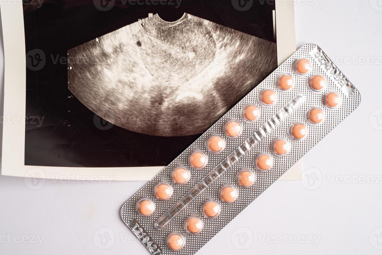 Birth control pills with ultrasound scan of baby uterus, contraception health and medicine. photo