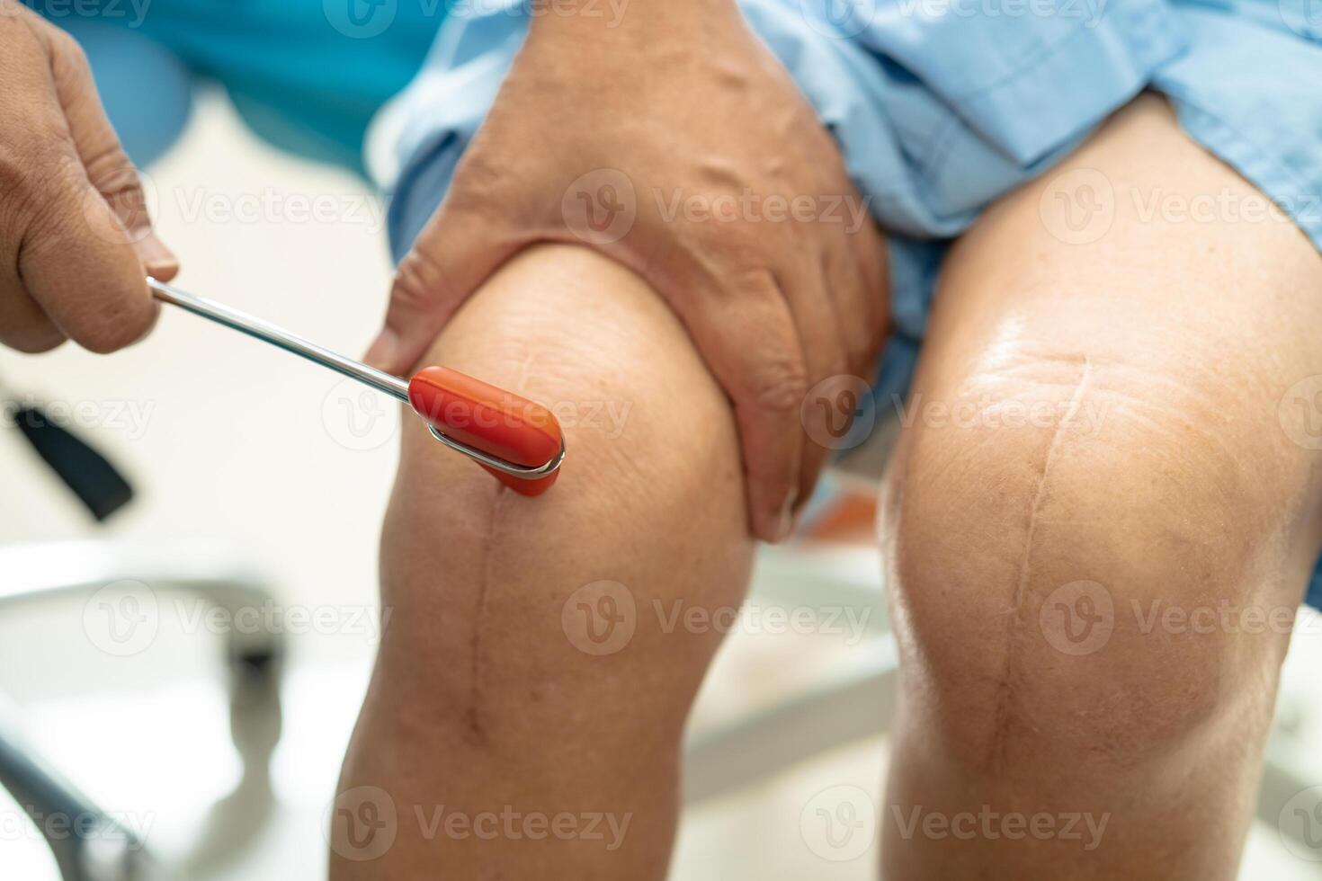 Asian doctor use hammer knock senior woman patient to check knee reflex, nerve and muscle in hospital. photo