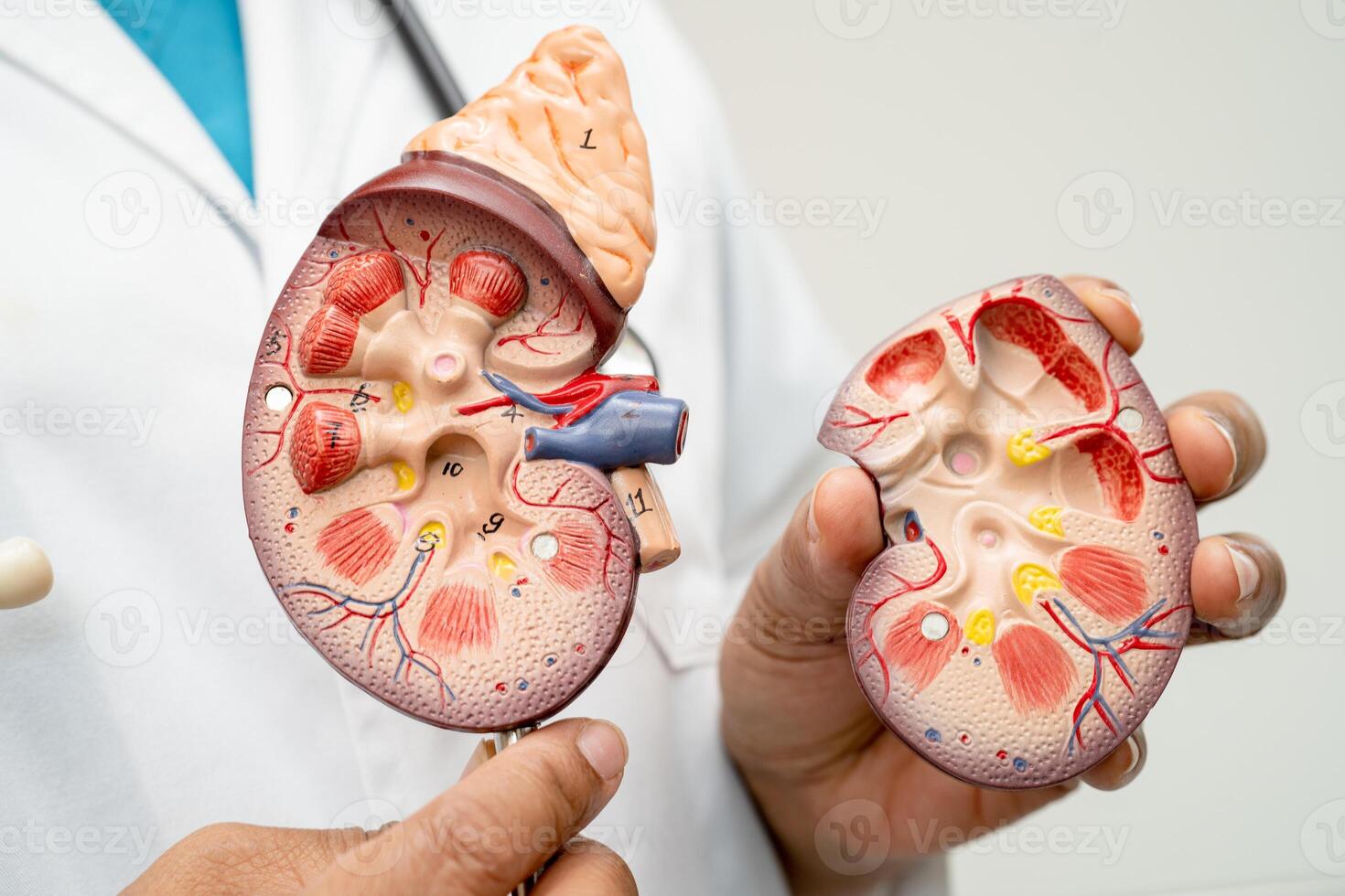 Kidney disease, Chronic kidney disease ckd, Doctor with human model to study and treat in hospital. photo