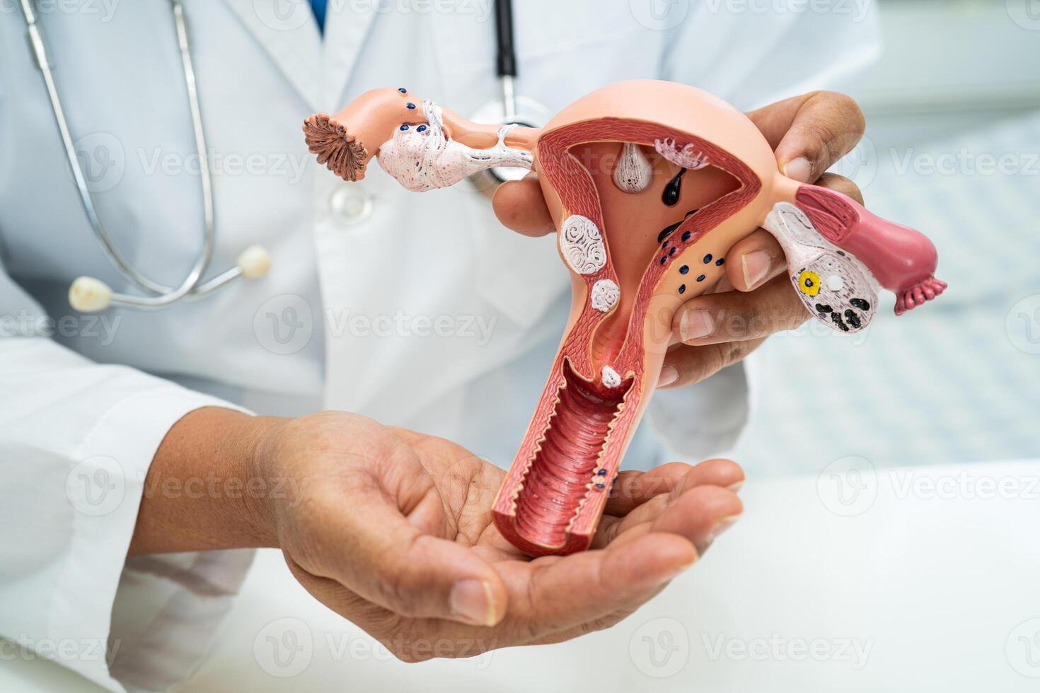 útero, médico con anatomía modelo para estudiar diagnóstico y tratamiento en hospital. foto
