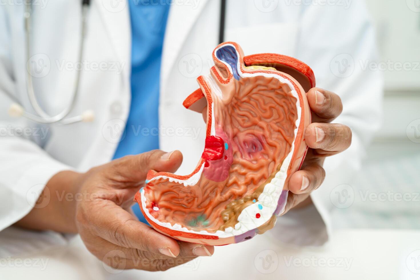 Stomach disease, doctor with anatomy model for study diagnosis and treatment in hospital. photo