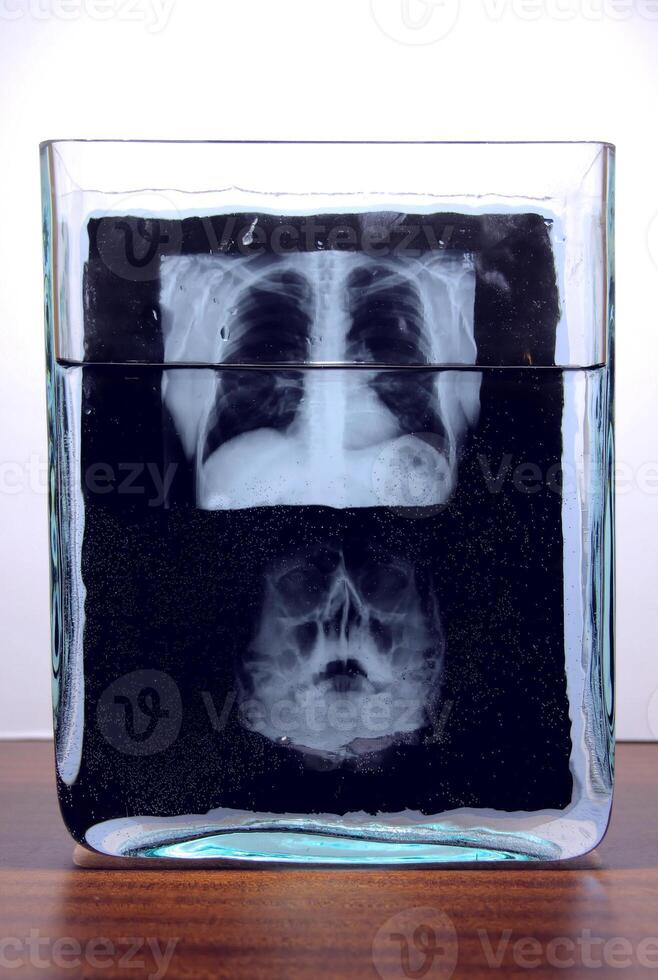 Radiography results film of human skull x-ray scanning in glass laboratory vessel with liquid photo