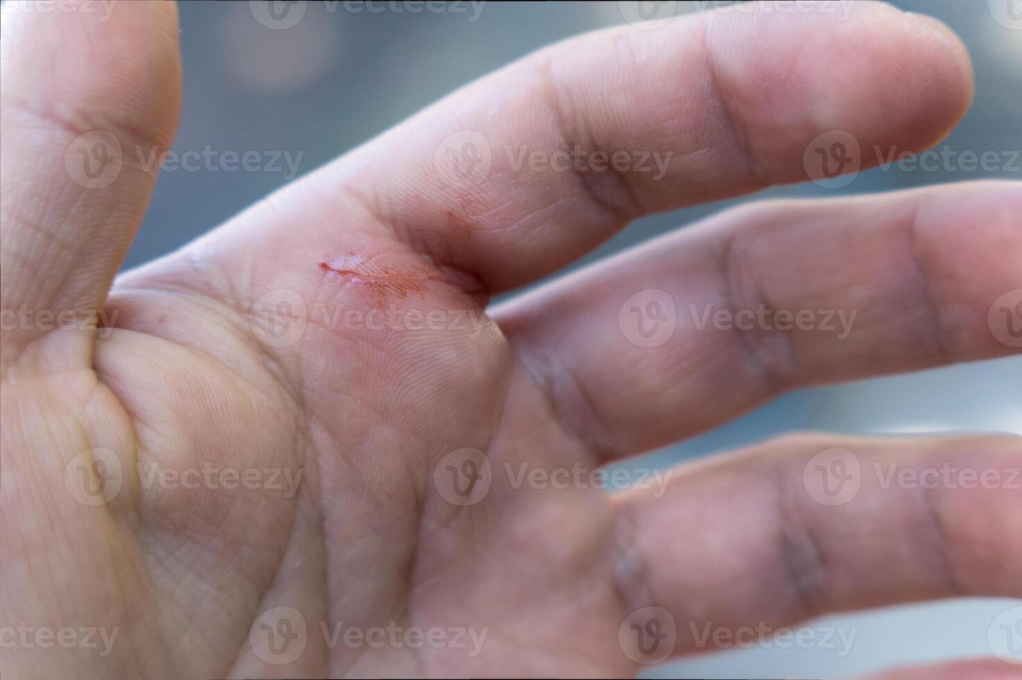 Hand fingers with accidental cut at home, with space for text photo