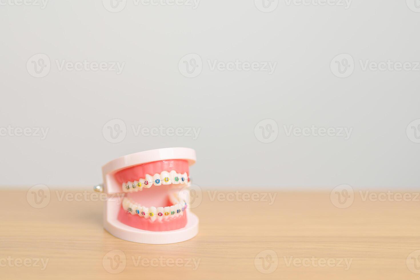 Orthodontic tooth model and bracket or brace. Clean and Scrape off tartar. May Orthodontic Health Day, March Oral health, Dentist Day, False Teeth. Toothache and Children Dental Health photo