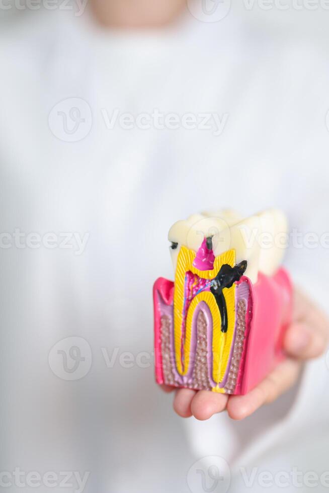 dentista con diente anatomía modelo. oral dientes decaer y enfermedad, raspar apagado sarro. marzo oral salud, dentista día, falso dientes. dolor de muelas y niños dental salud mes y ortodoncia salud día foto