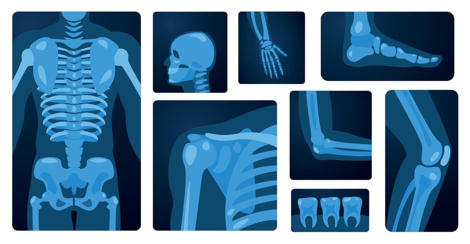 X ray body parts. Human skeleton knee arm chest wrist foot, medical x-ray imaging concept of bone injury. Vector flat set