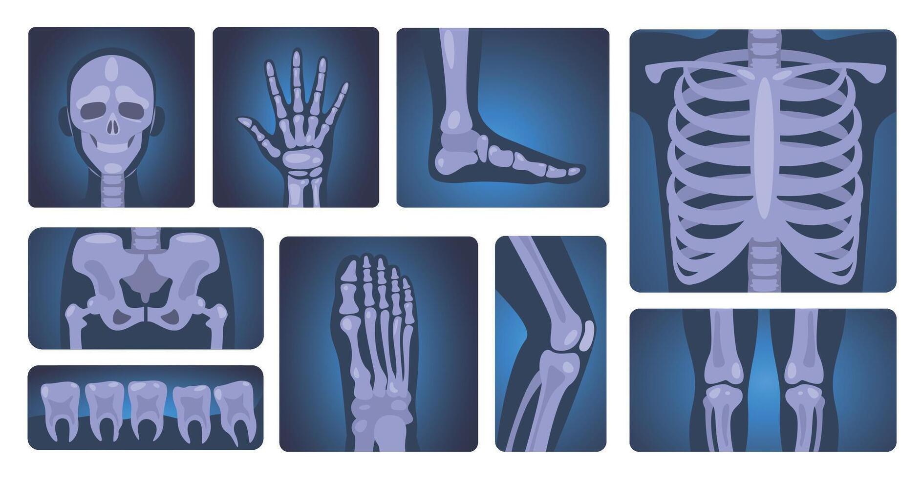 X-ray shots. Human skeleton and body parts, medical diagnosis and healthcare concept, anatomy and science vector set