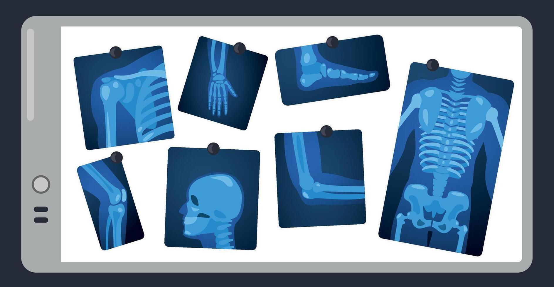 X ray on doctor screen. Human skeleton parts on surgery light pad, body parts medical x-ray concept. Vector illustration