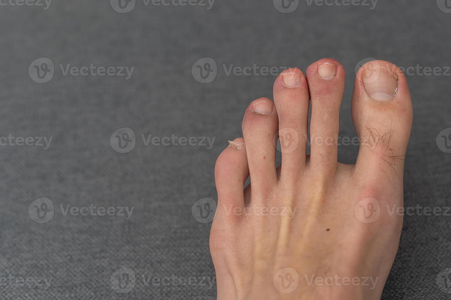 Male foot, toes, with untidy and untrimmed nails. Men's pedicure on a dark background. photo