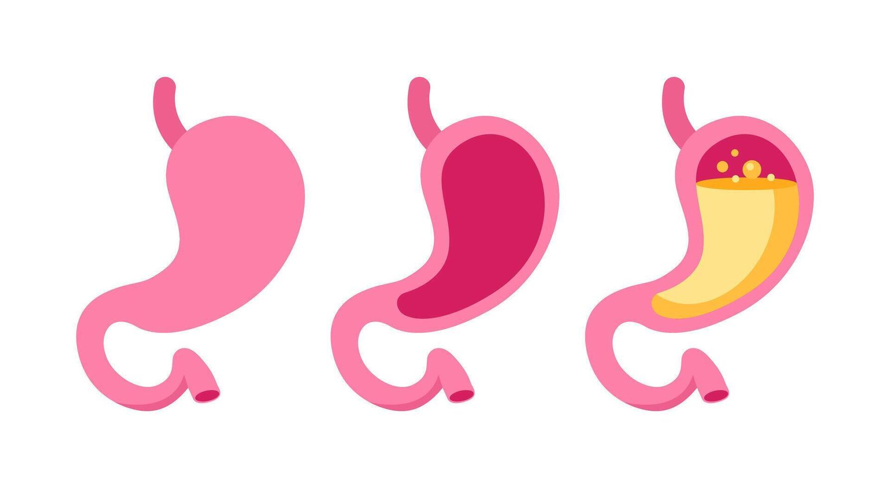 Set of stylized stomach icons in shades of pink, depicting various states of stomach health and conditions vector