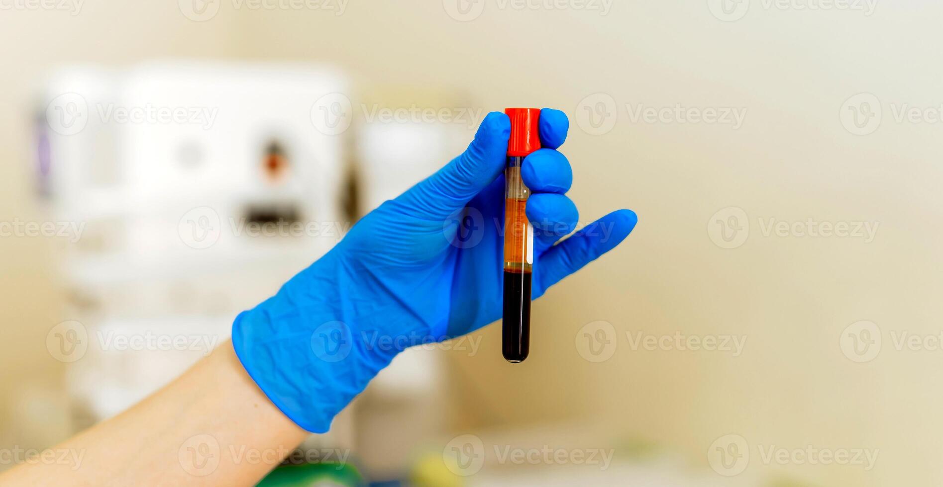 Hand in blue latex gloves holding blood sample vial in modern clinic background. Closeup. photo