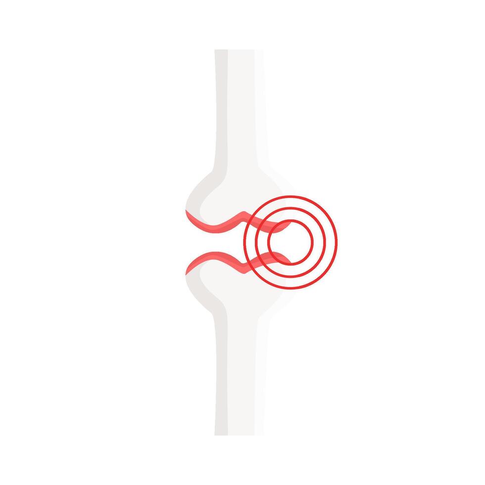 bone knee illustration vector