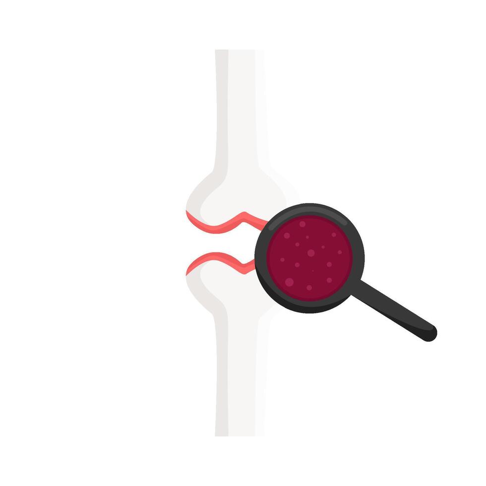 bone knee human with magnifying glass illustration vector