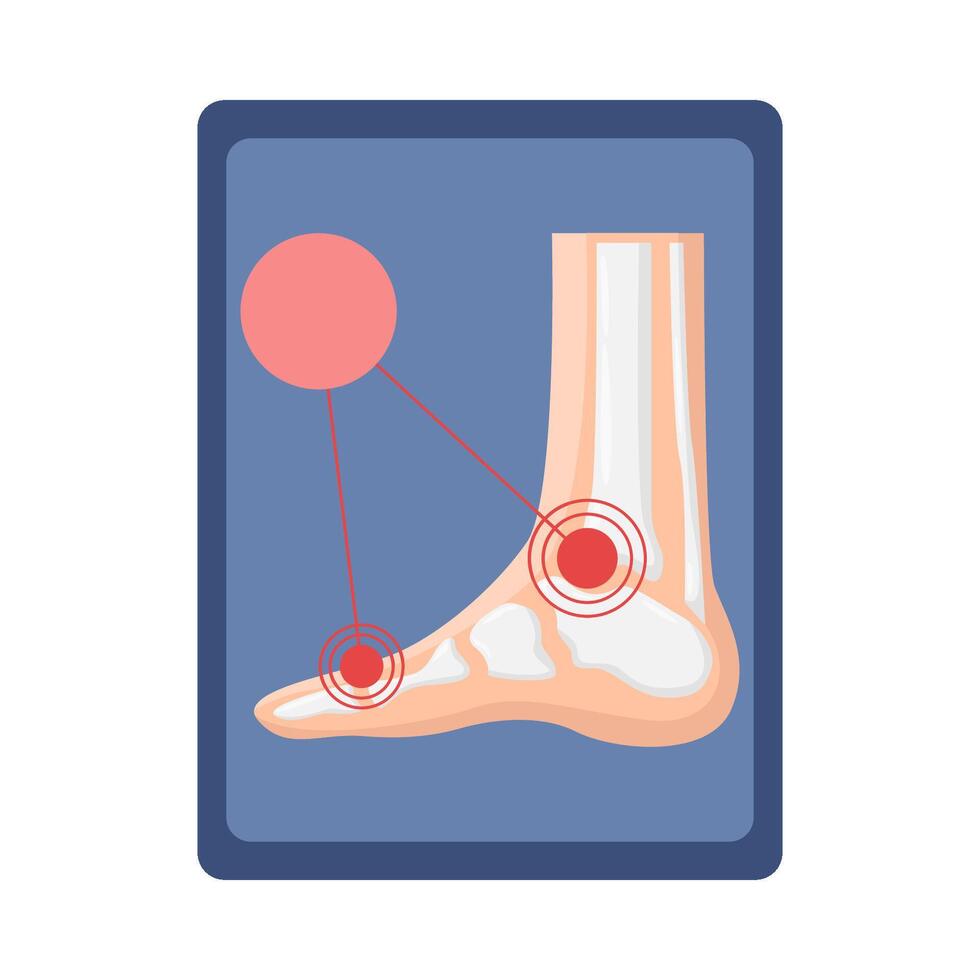 bone foot illustration vector