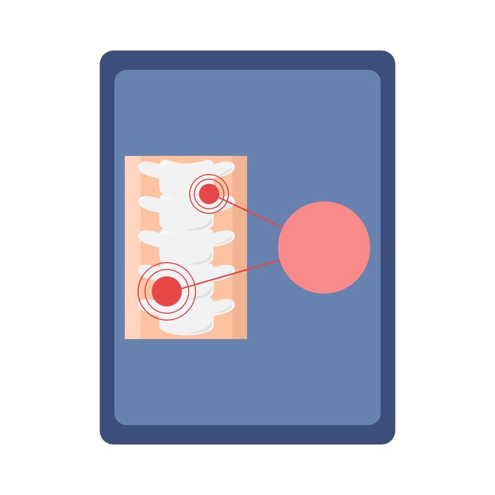throat bone human in board illustration vector