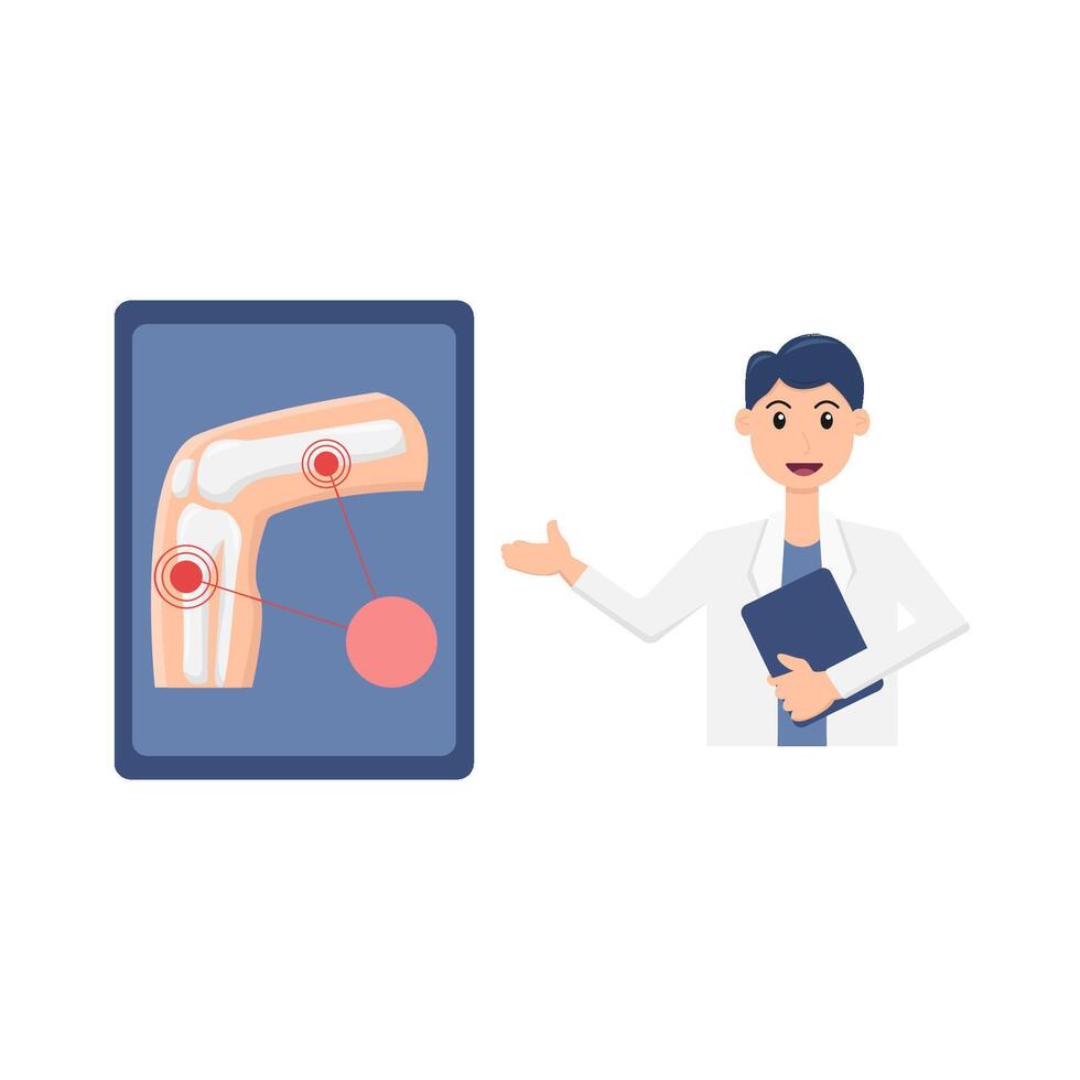 bone knee with doctor illustration vector