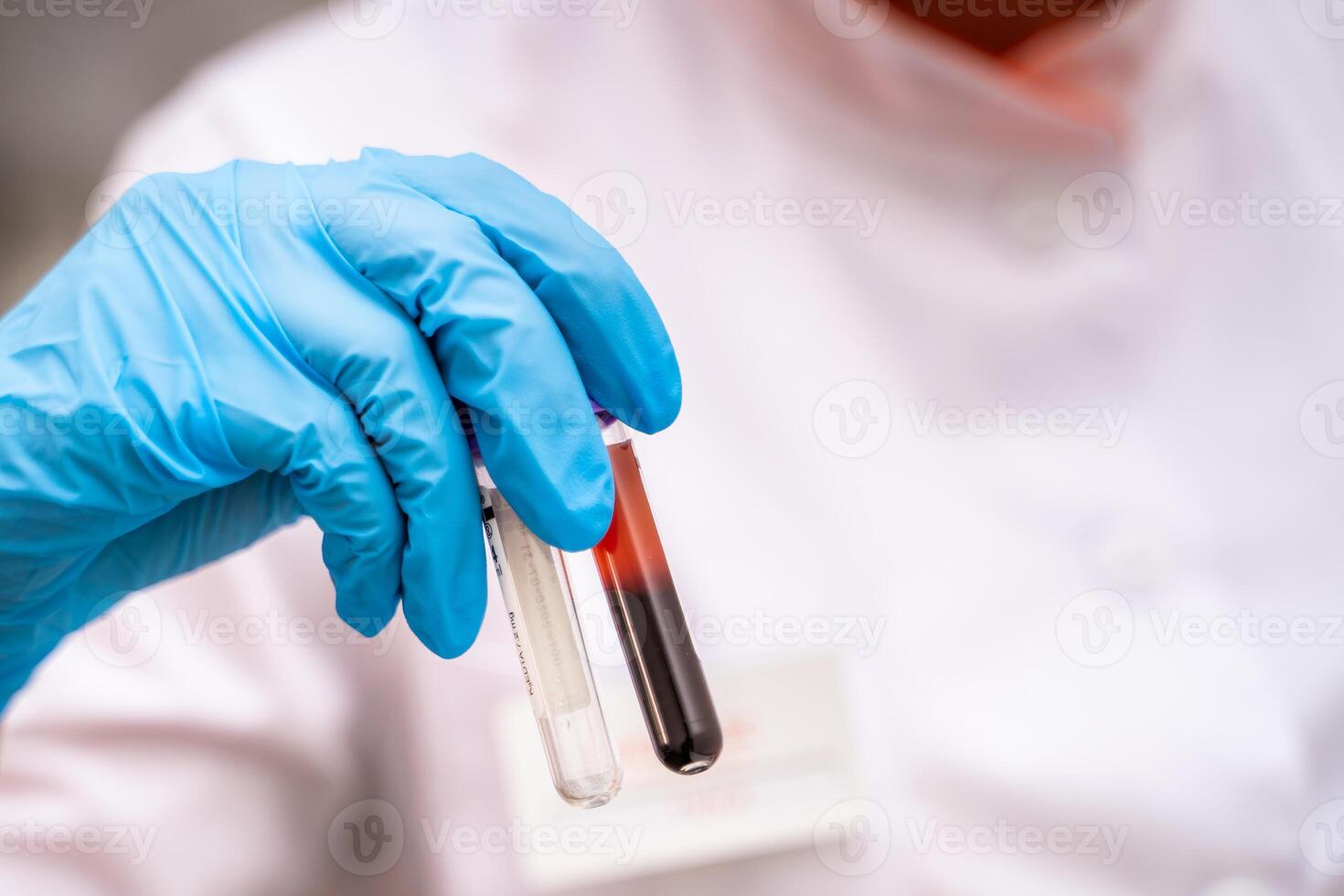 Test tubes with blood in hand. Medical equipment photo