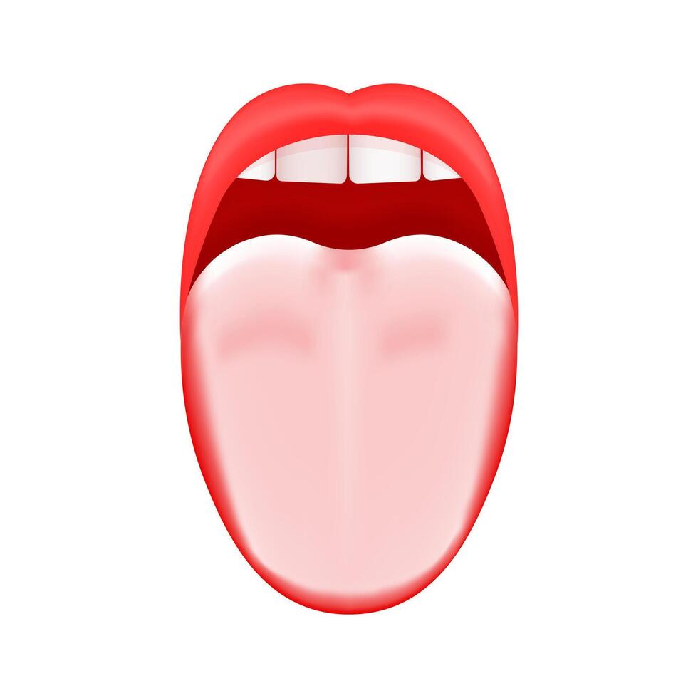 White or coated tongue. Dry mouth. Open human taste organ with symptoms of stomatitis, candidiasis or glossitis bacterial infection vector