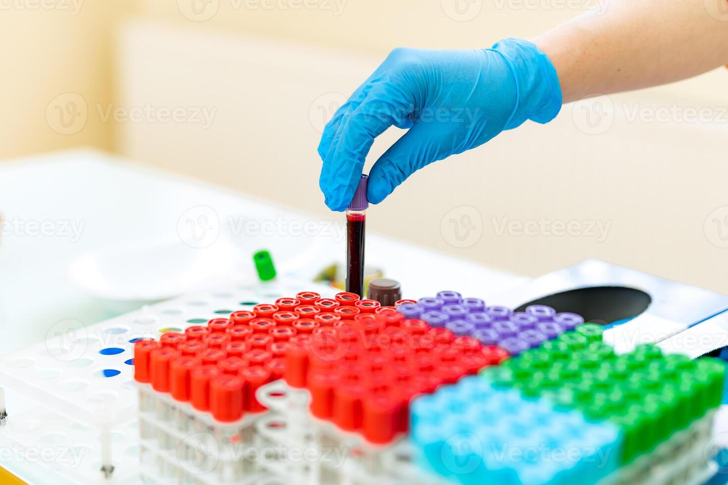 Female nurse puts blood samples in tubes onto a special rack on a table. Doctor's hands in blue latex gloves put the test tube in a rack with many colorful vials in a laboratory. Close-up. photo