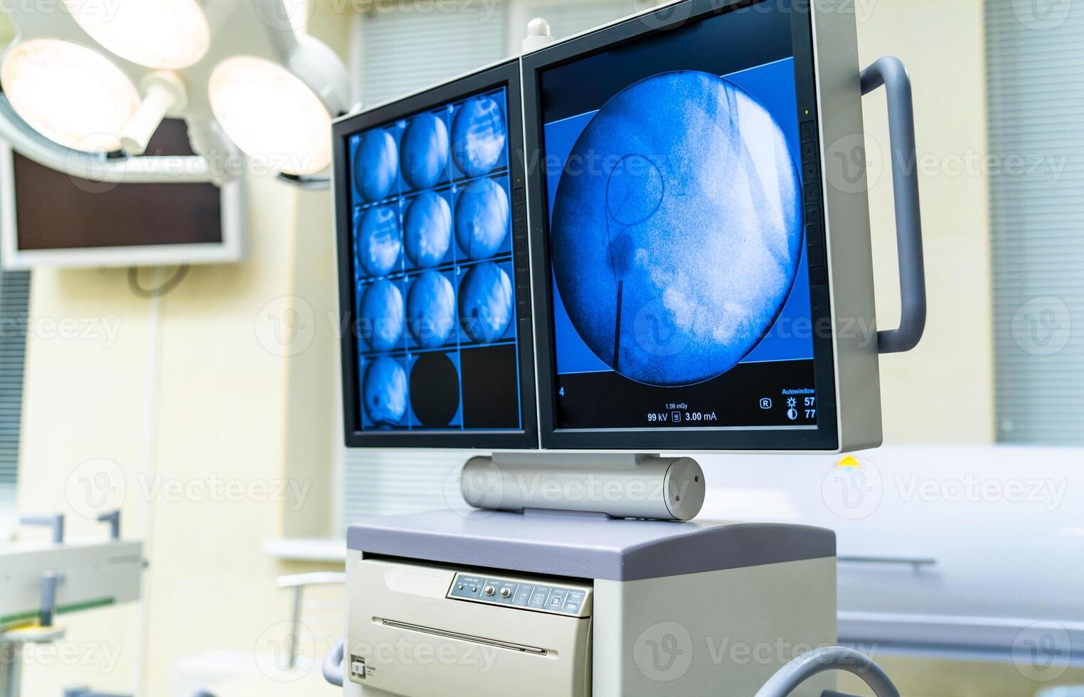 avanzado tecnología, colección de paciente pruebas en el monitor durante cirugía. operando y cirugía concepto. foto