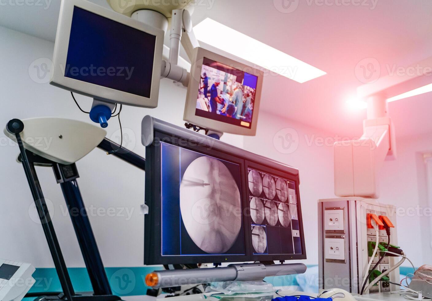 Modern equipment in operating room. Spine Surgery. Group of surgeons in operating room photo