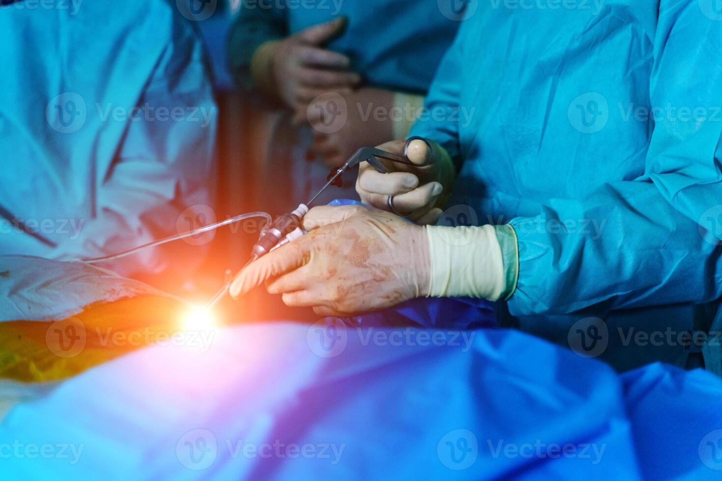 Spinal surgery. Group of surgeons in operating room with surgery equipment. Laminectomy. Modern medical background photo