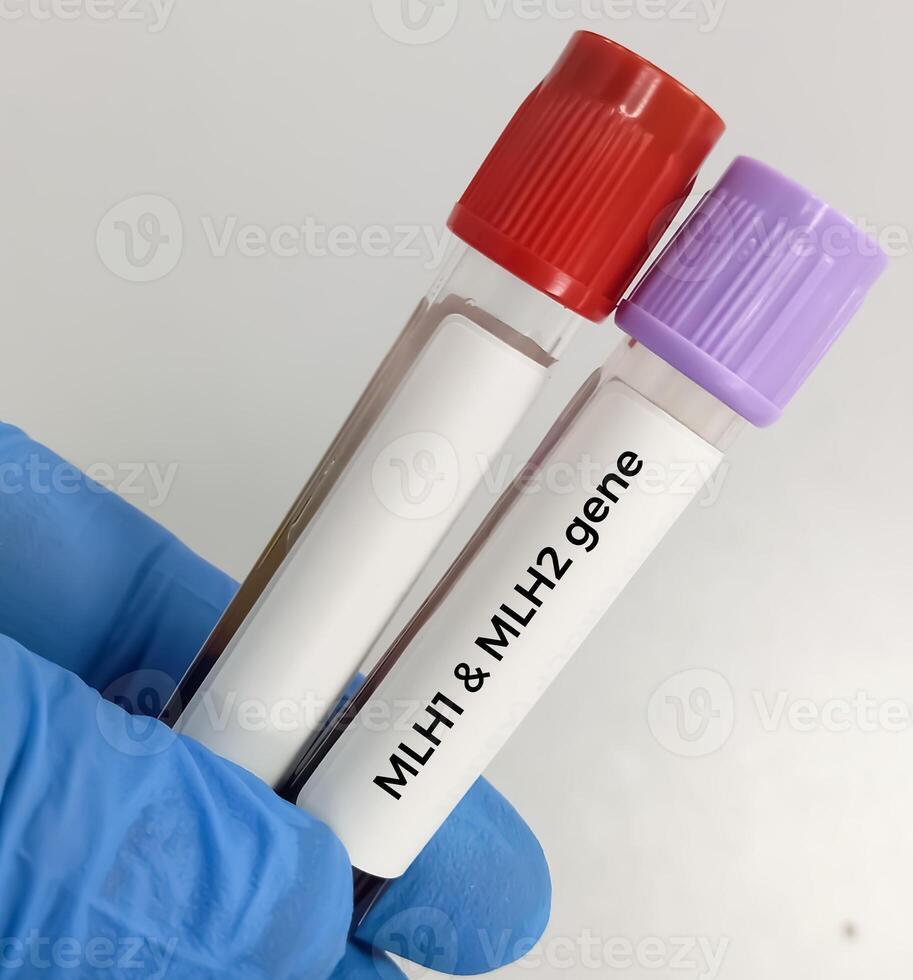 Blood sample for MLH1 or MSH2 test. Hereditary cancer panel test, Lynch syndrome or HNPCC or hereditary non-polyposis colorectal cancer. photo