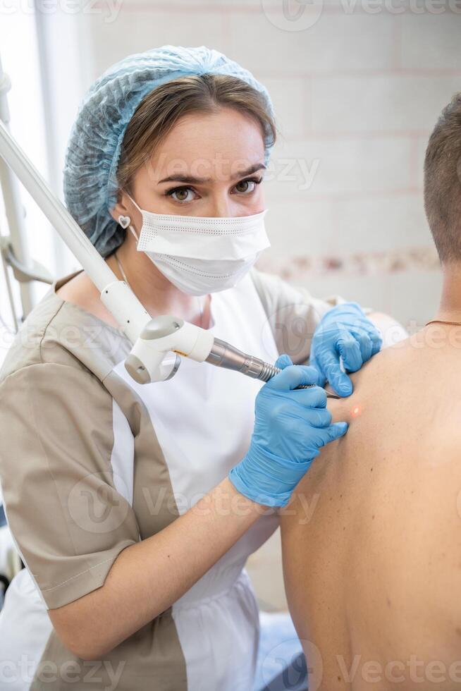A dermatologist removes skin tumors with a laser, the process of removing skin diseases photo