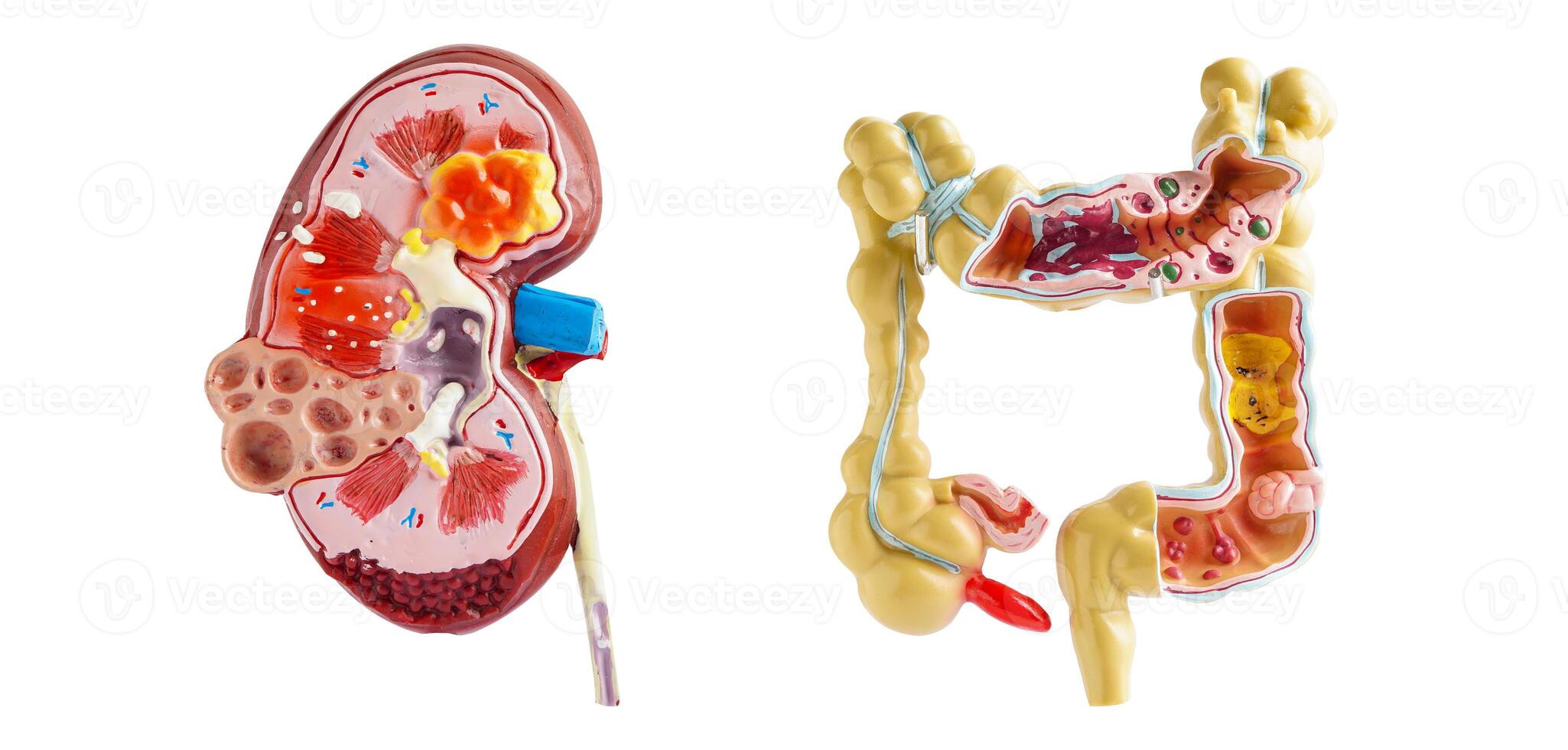 Kidney and intestine model isolated on white background, doctor holding anatomy model for study diagnosis and treatment in hospital. photo