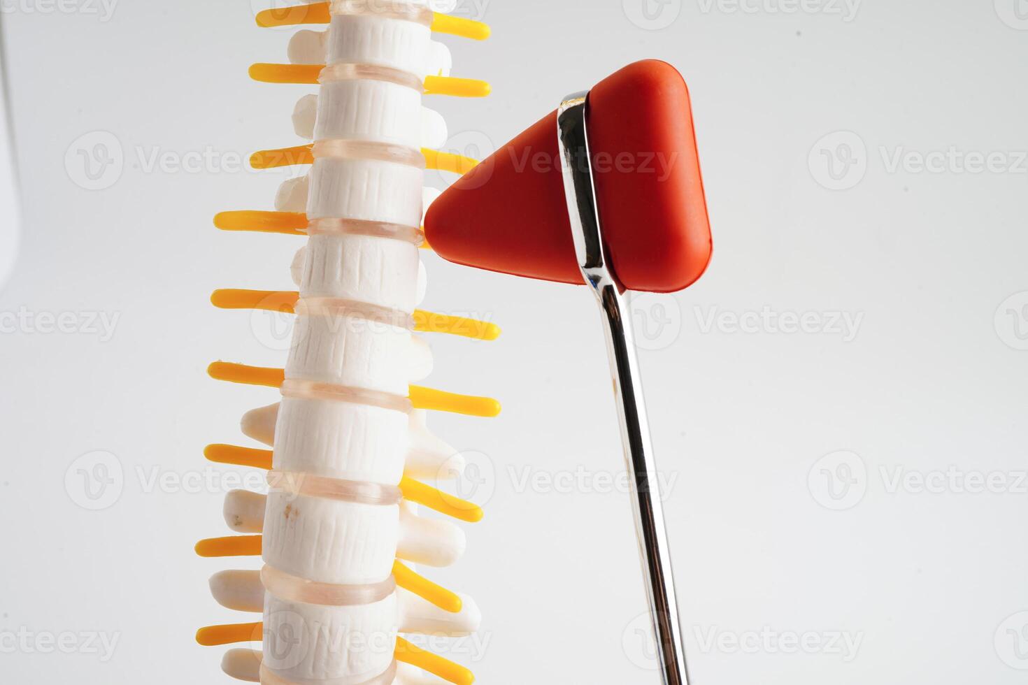 Spinal nerve and bone with knee reflex hammer, Lumbar spine displaced herniated disc fragment, Model for treatment medical in the orthopedic department. photo
