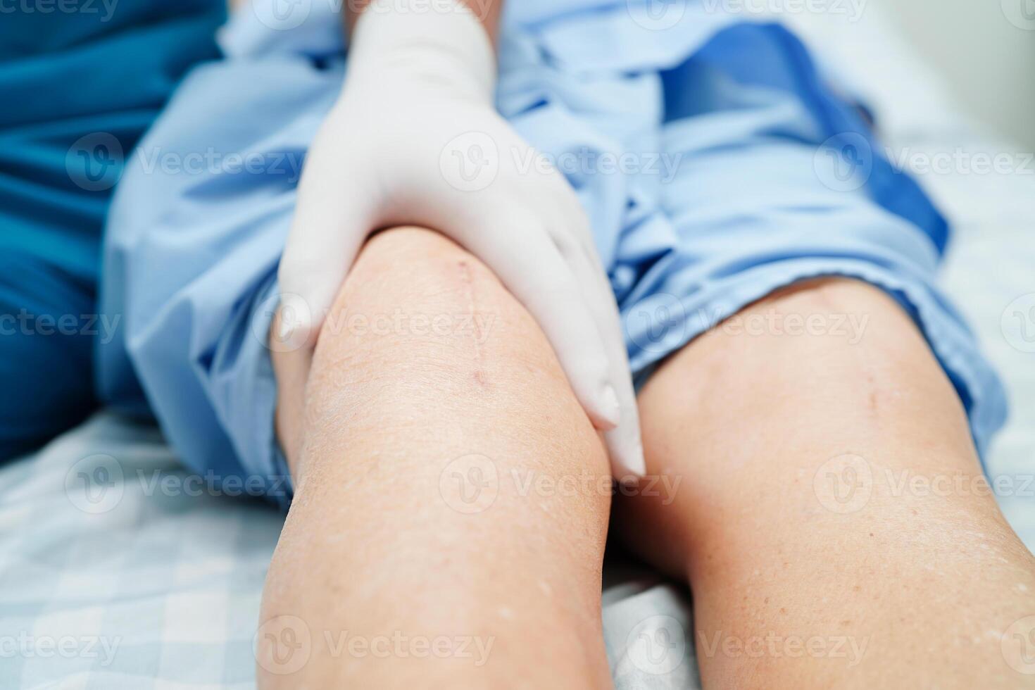 Doctor checking Asian elderly woman patient with scar knee replacement surgery in hospital. photo