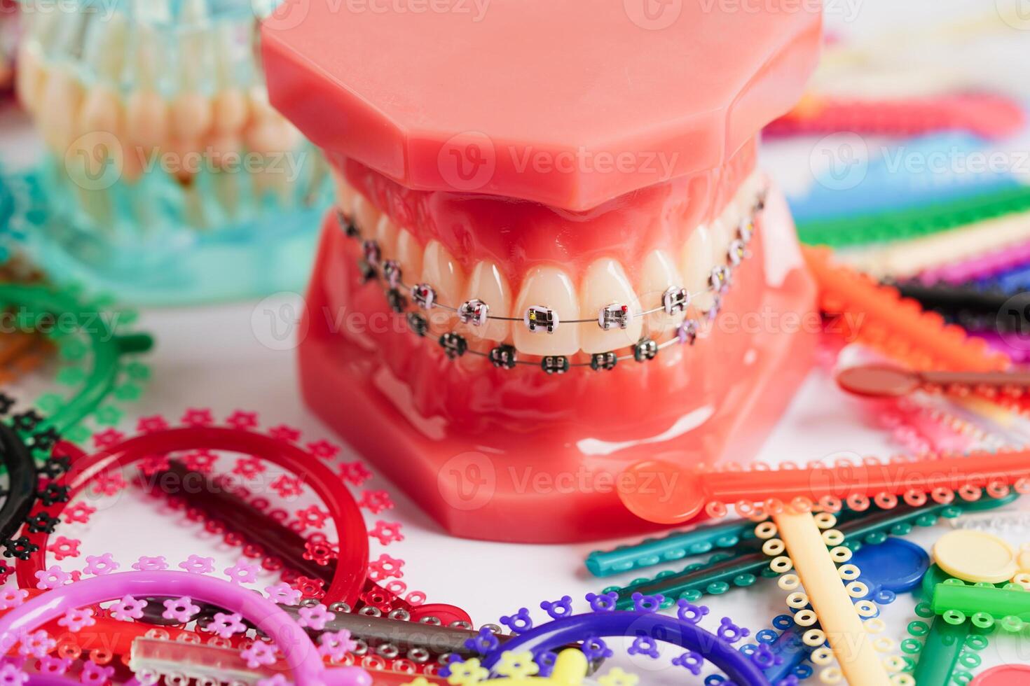 Orthodontic ligatures rings and ties, elastic rubber bands on orthodontic braces, model for dentist studying about dentistry. photo