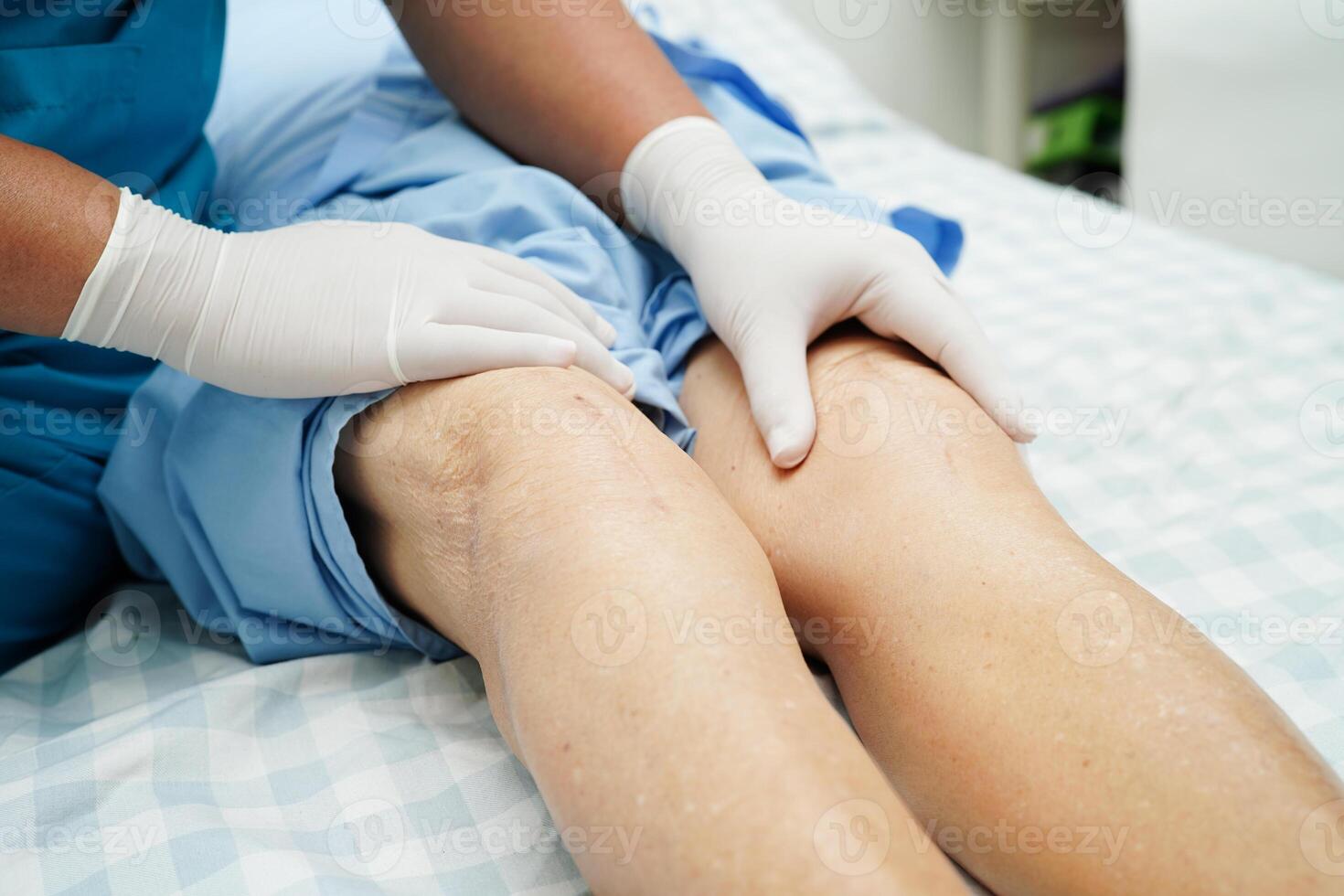 Knee Replacement Surgery In Max Hospital Doctor checking Asian elderly woman patient with scar knee replacement