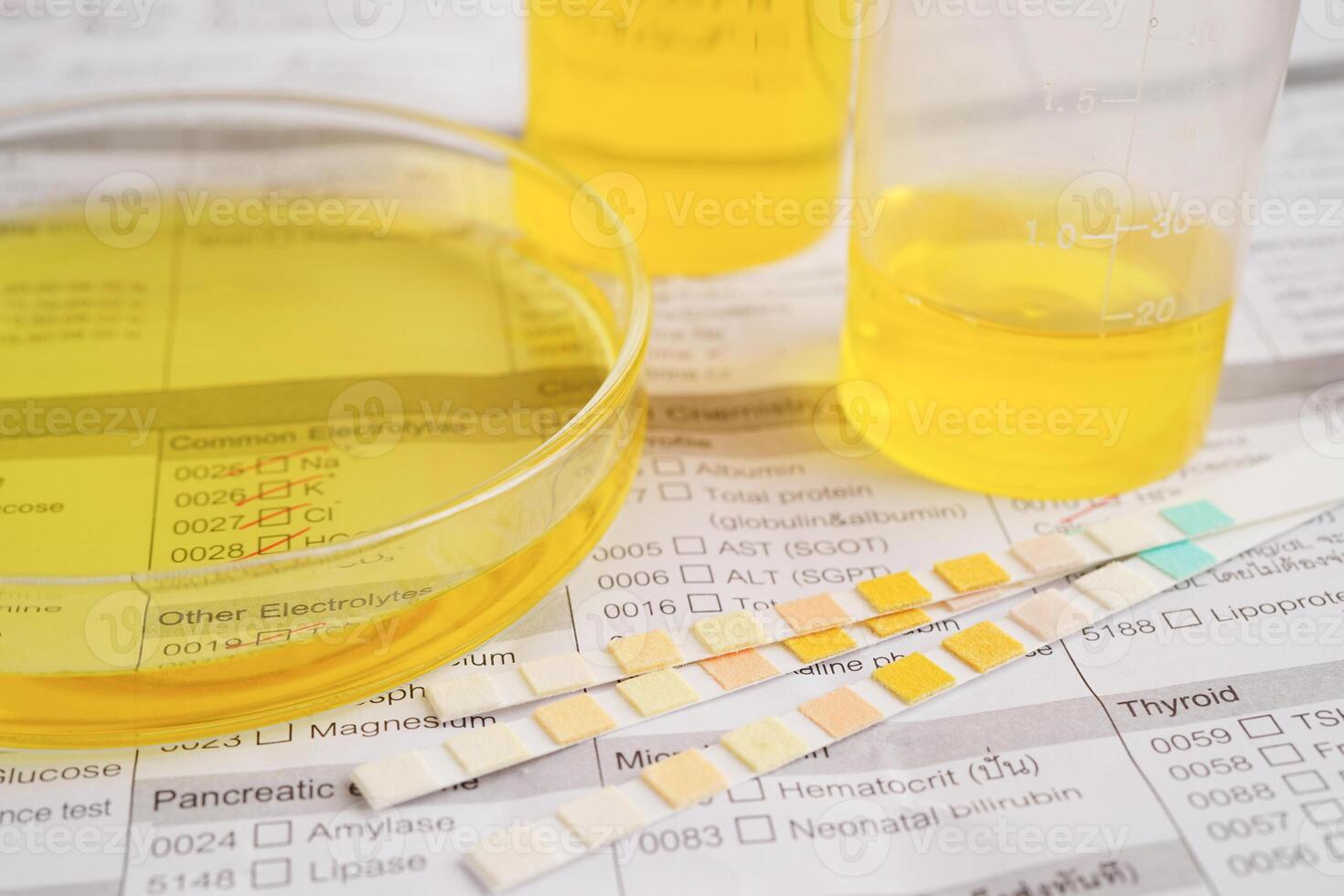 Urinalysis, urine cup with reagent strip pH paper test and comparison chart in laboratory. photo