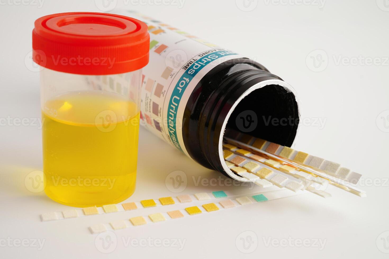 Urinalysis, urine cup with reagent strip pH paper test and comparison chart in laboratory. photo