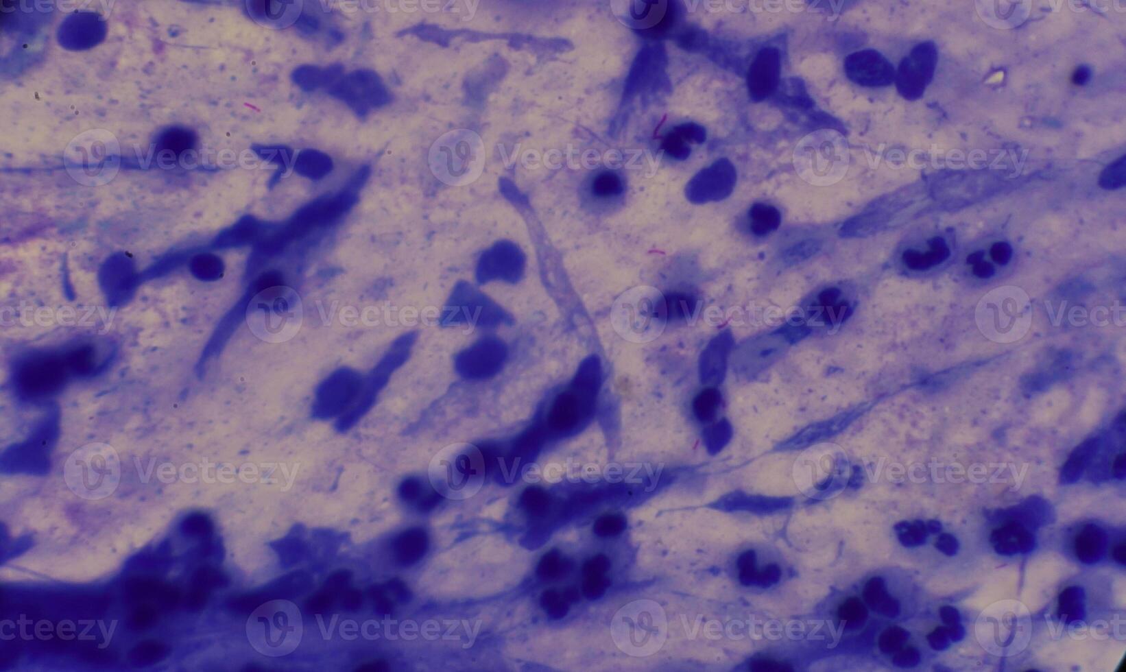 micobacteria tuberculosis apariencia debajo el microscopio es rojo con afb tinción foto