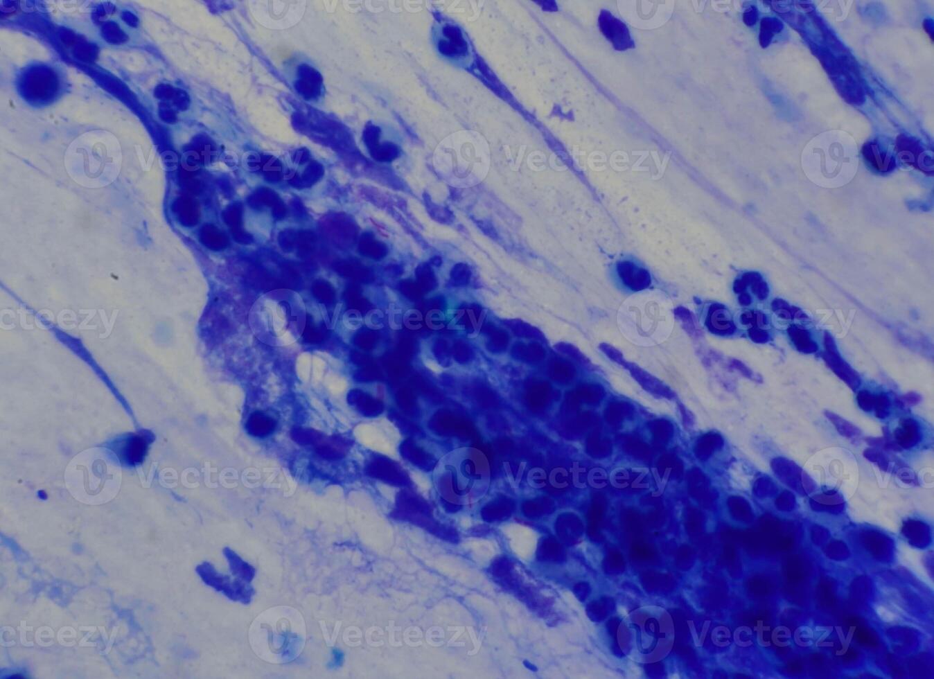 Mycobacterium tuberculosis appearance under the microscope is red with AFB staining photo