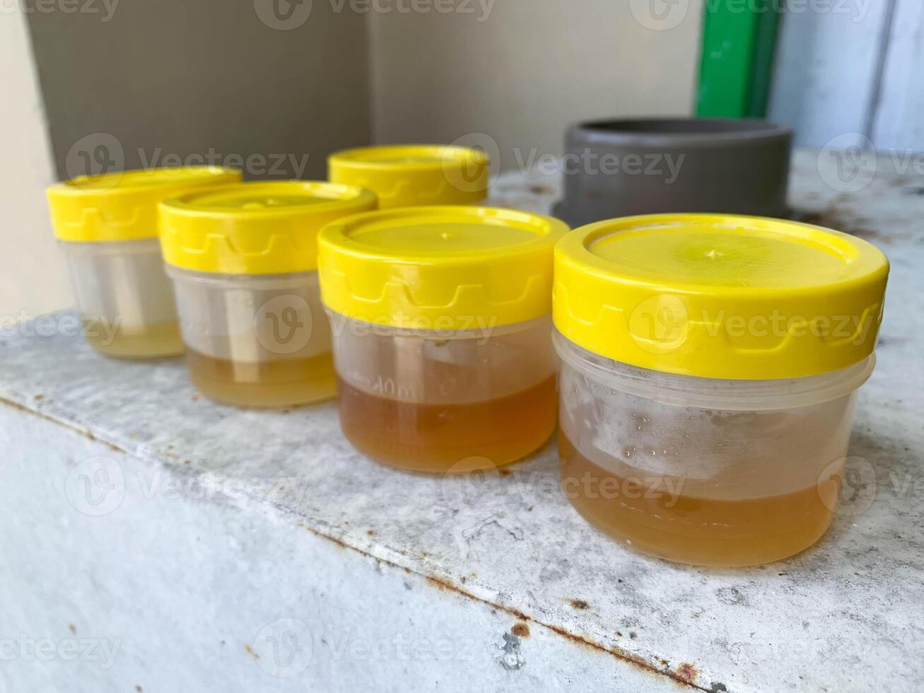 a collection of yellow urine samples on the table for laboratory examination photo