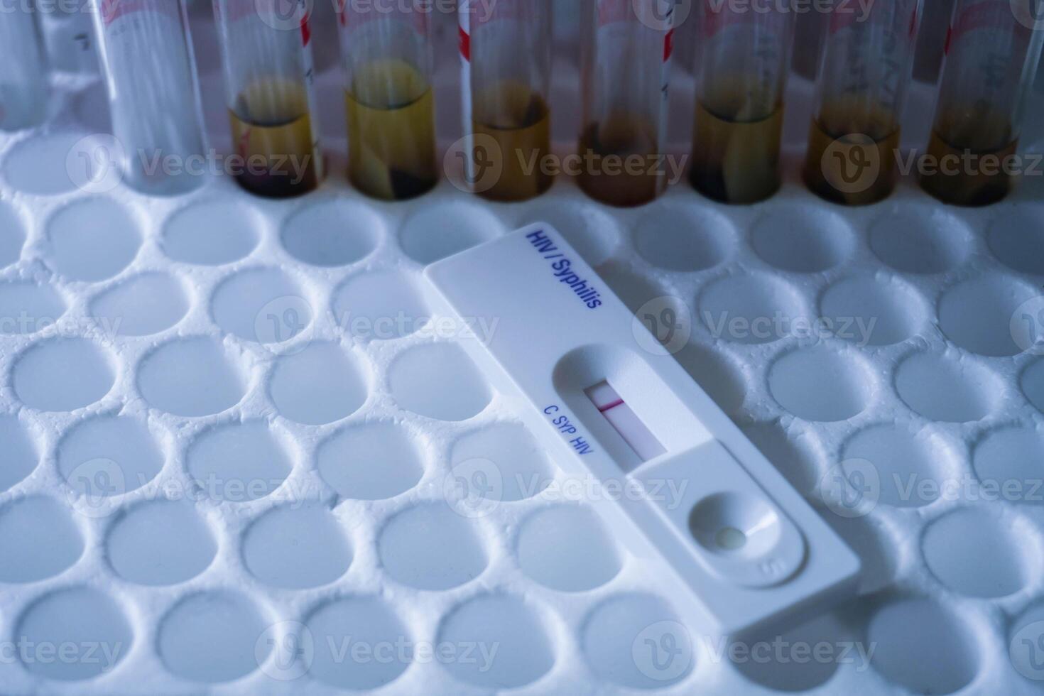 rapid test cassette of HIV showing negative test result. above the red vacuum tube photo