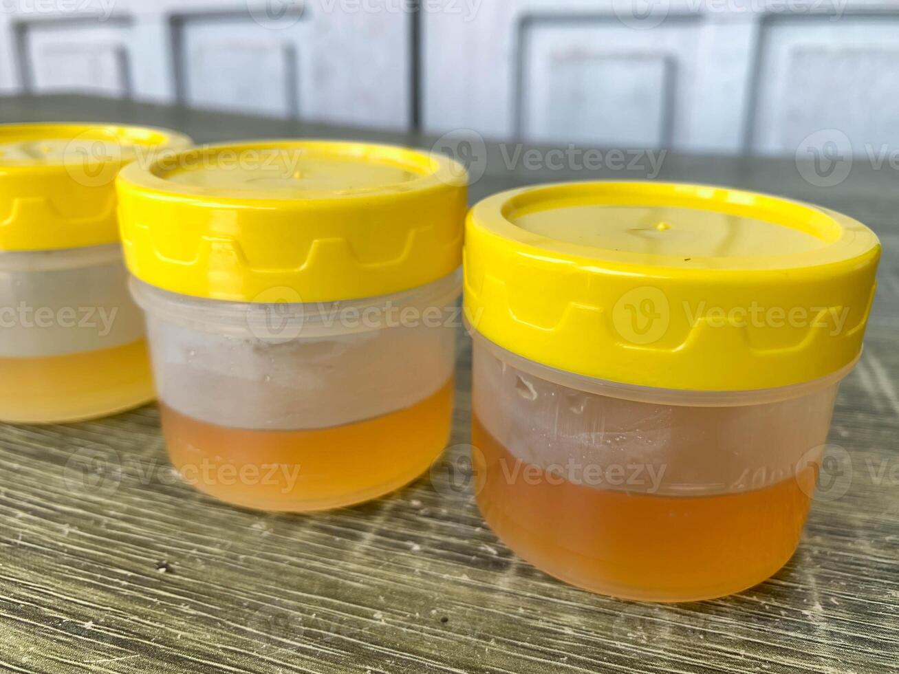a collection of yellow urine samples on the table for laboratory examination photo