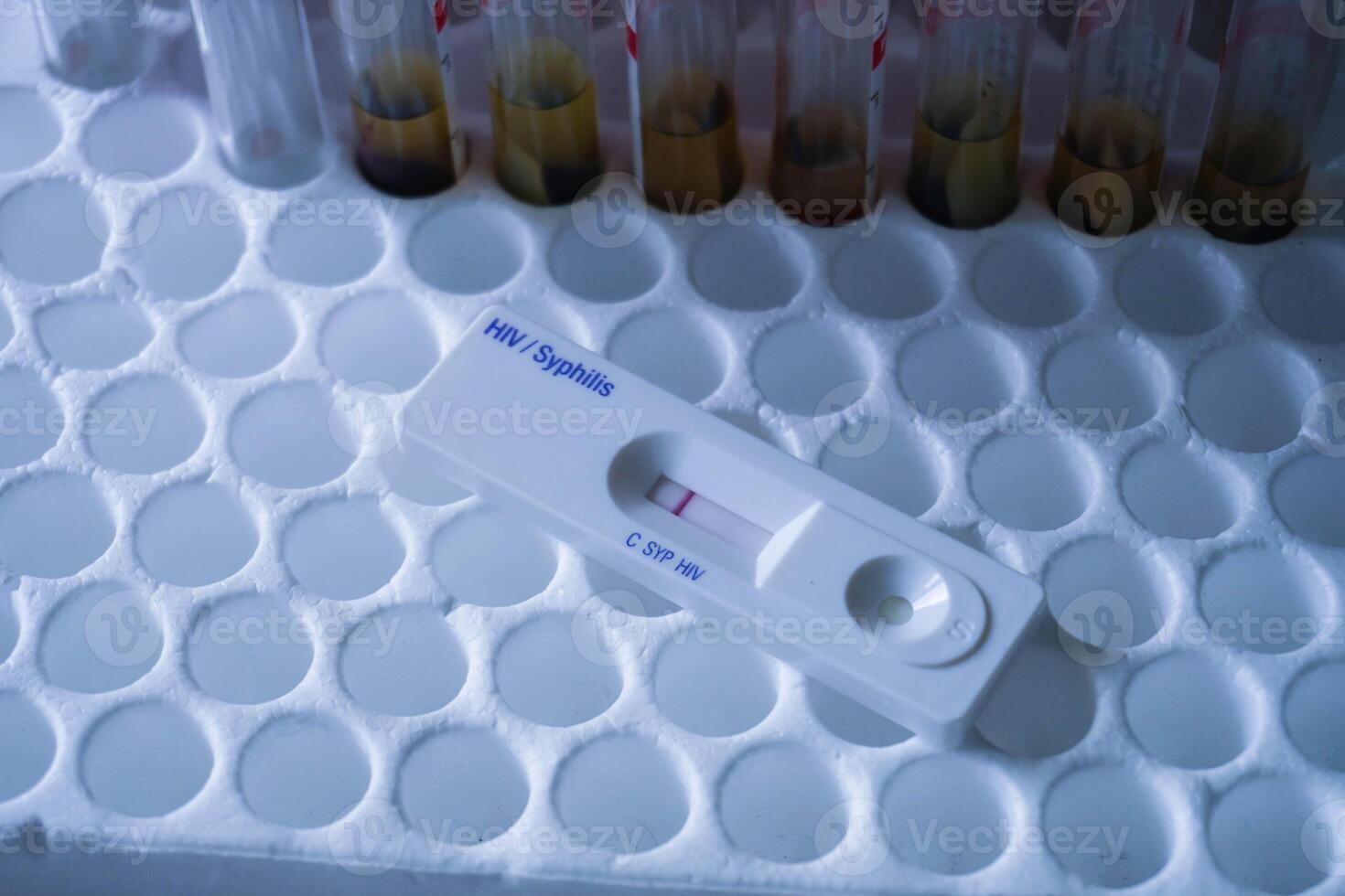 rapid test cassette of HIV showing negative test result. above the red vacuum tube photo