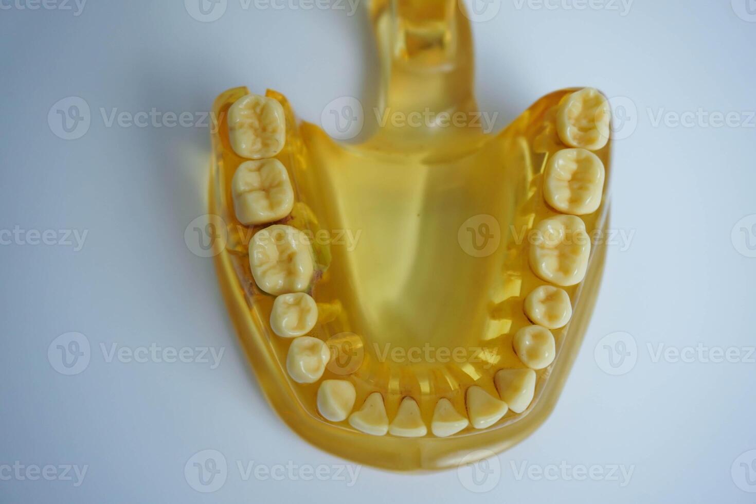 yellow jaw model on white background. Dentures or false teeth photo