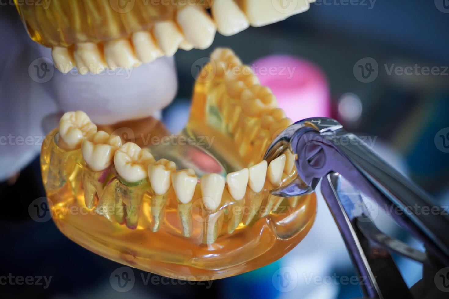 Dentist with a layout of the human jaw is showing how to extract a sick tooth with dental pliers. photo