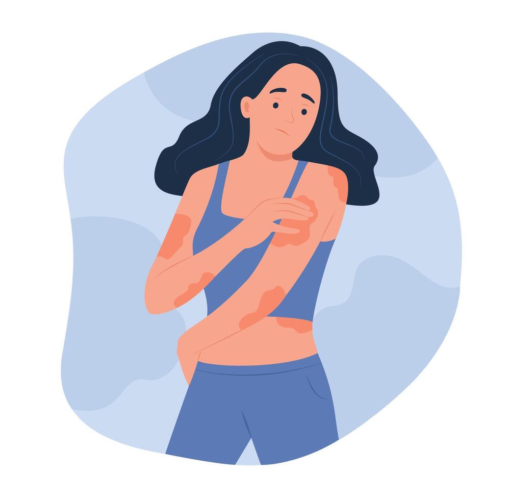 Woman Looking Eczema on Body for Dermatology Concept Illustration vector
