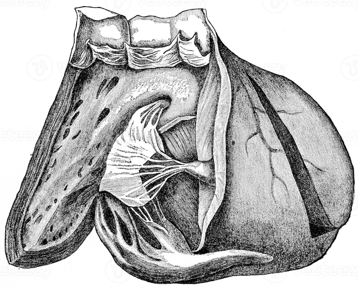 Heart showing the interior and the right ventricle and pulmonary artery, vintage engraving. photo