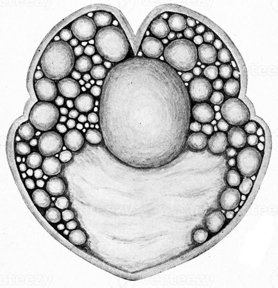 Hydatid cyst, showing daughter cysts, vintage engraving. photo