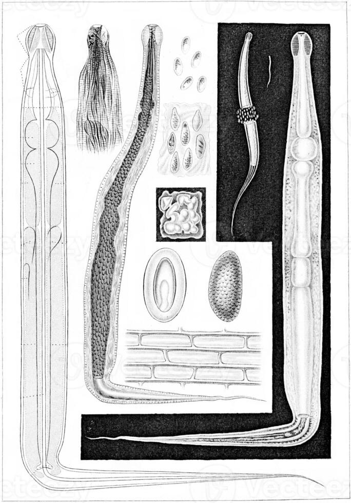 Topography of the organs, vintage engraving. photo